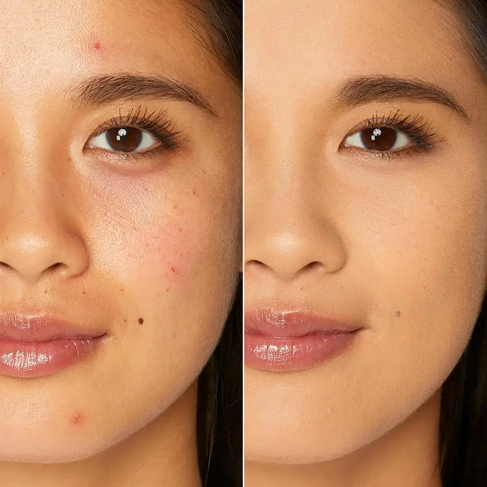 Waterproof Liquid Foundation Oil-control Concealer Dark Circles Acne Covering Black Circles Acne Marks Blemishes Spots Makeup