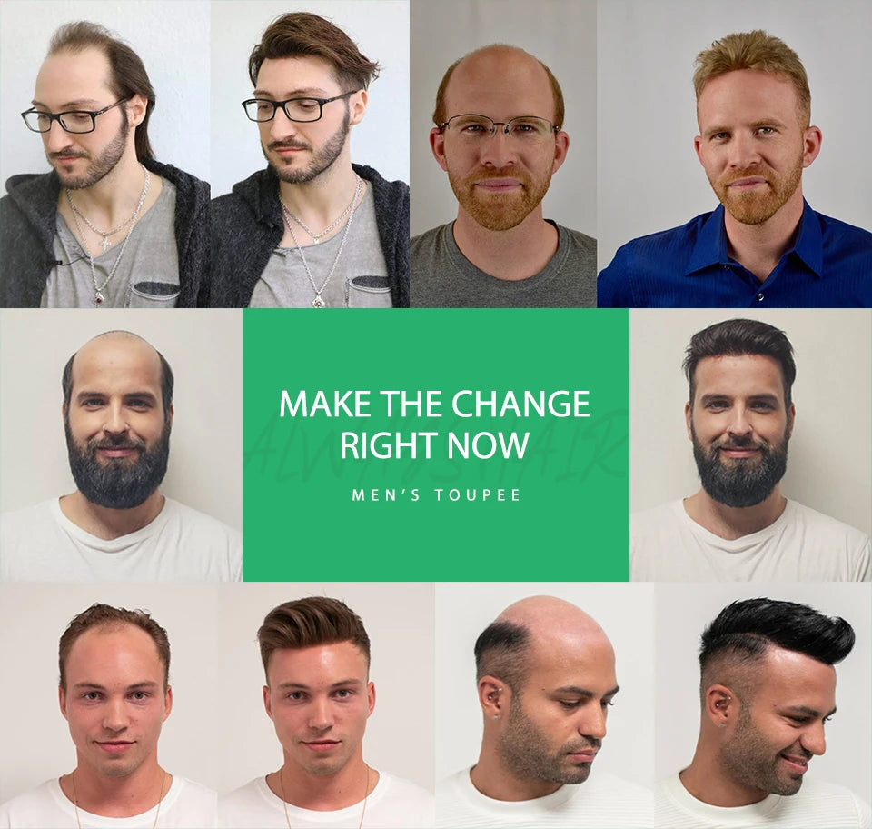 Alwayshair-DUAR Q6 Hair System Invisible Hairline Men Toupee Lace & PU Natural Indian Hair Prosthesis 130 Hair Patch for Man Wig